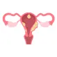Uterus Cancer Surgery